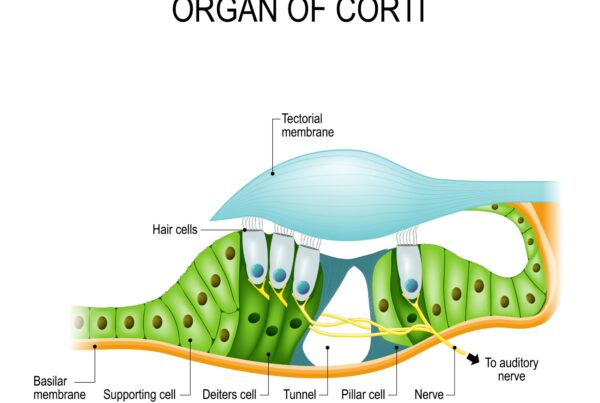 genetic hearing loss